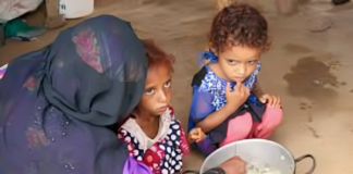 اليمن يتصدر 17 بلداً تعاني أعلى مستويات الجوع