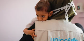 يونيسف: محافظة ريمة تسجل أعلى معدل تقزم بين الأطفال في اليمن