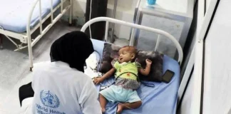 تقرير: 11 ألف إصابة بالكوليرا في اليمن خلال الربع الأول من 2025 وفق إحصائية أممية