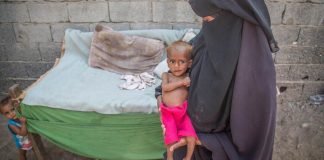 تقرير: 85 ألف طفل يمني ماتوا من الجوع: أزمة اليمن أسوأ بكثير من غزة – ومع ذلك يتجاهلها العالم