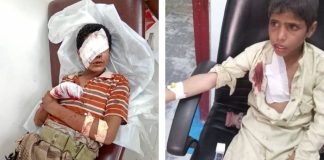 الجوف.. إصابة طفلين بانفجار قذيفة من مخلفات الحوثيين في المتون