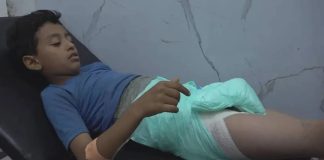 إصابة طفل برصاص قناص حوثي شرقي مدينة تعز