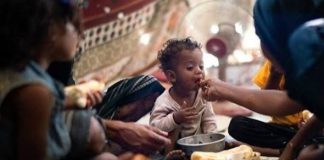 تحذير أممي من ارتفاع في معدلات سوء التغذية لدى أطفال اليمن دون العامين