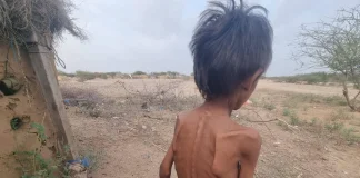 الجوع ينهش اليمن… والحوثيون يستخفون بالمأساة